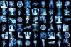 depositphotos_63807753-stock-photo-x-ray-multiple-part-of-1